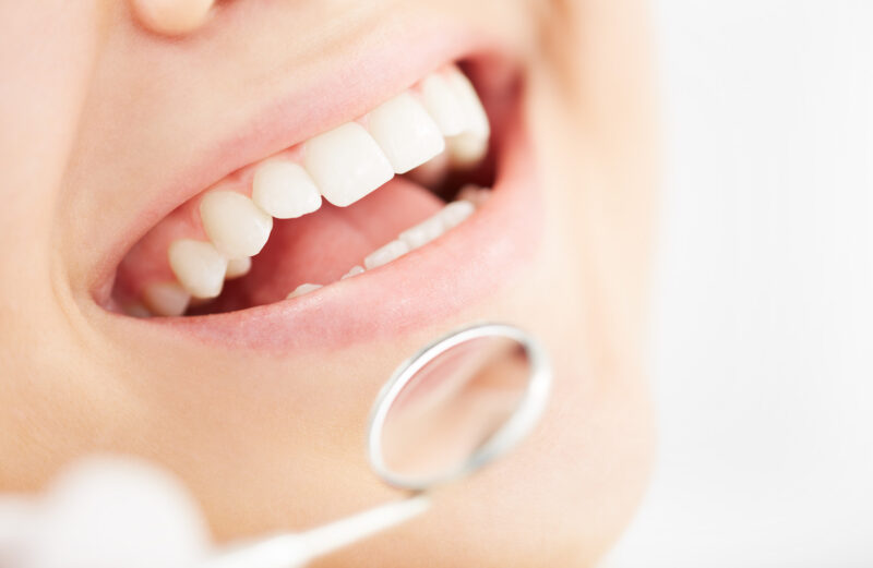 smiling teeth, dental mirror, smiling girl with white teeth