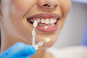 Dentist, cleaning and dental procedure for toothache in clinic, health and treatment for mouth.